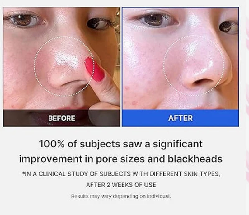Medicube Zero Pore Padsl